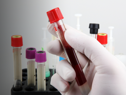 Thumbnail for CAF Awards $250,000 in Medical Research Fellowships for 2025-2026